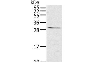 Western Blot analysis of Mouse kidney tissue using TNFSF15 Polyclonal Antibody at dilution of 1:600 (TNFSF15 Antikörper)