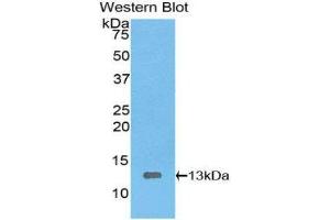 Western Blotting (WB) image for anti-High Mobility Group AT-Hook 1 (HMGA1) (AA 1-107) antibody (ABIN1078144) (HMGA1 Antikörper  (AA 1-107))