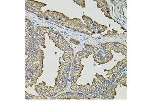 Immunohistochemistry of paraffin-embedded human prostate using SMN2 antibody.