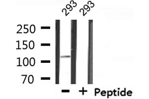 Western blot analysis of extracts from 293, using MED24 Antibody. (MED24 Antikörper  (C-Term))