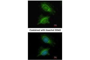 ICC/IF Image Immunofluorescence analysis of methanol-fixed HeLa, using PGM3, antibody at 1:200 dilution. (Phosphoglucomutase 3 Antikörper)