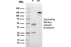 SDS-PAGE Analysis Puriifed BrdU Recombinant Mouse Monoclonal Antibody (rBRD.