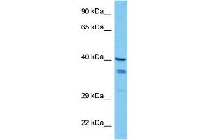 Western Blotting (WB) image for anti-Wingless-Type MMTV Integration Site Family, Member 7B (WNT7B) (Middle Region) antibody (ABIN2776732)