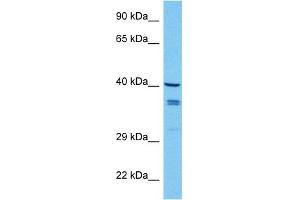 Host:  Mouse  Target Name:  WNT7B  Sample Tissue:  Mouse Spleen  Antibody Dilution:  1ug/ml (WNT7B Antikörper  (Middle Region))