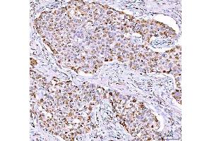 IHC analysis of PPA2 using anti-PPA2 antibody (ABIN6719431).