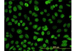 Immunofluorescence of monoclonal antibody to EMD on HeLa cell. (Emerin Antikörper  (AA 1-110))