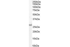 ABIN185615 (1µg/ml) staining of Human Duodenum lysate (35µg protein in RIPA buffer). (VTI1B Antikörper  (Internal Region))