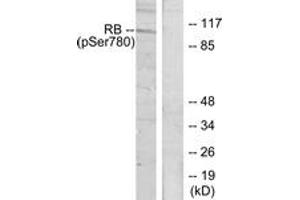 Western blot analysis of extracts from K562 cells treated with serum 10%, using Retinoblastoma (Phospho-Ser780) Antibody. (Retinoblastoma Protein (Rb) Antikörper  (pSer780))