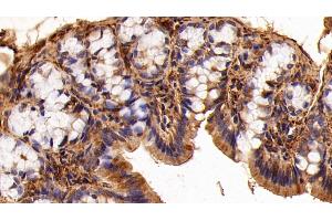 Immunohistochemistry (IHC) image for anti-Lectin, Galactoside-Binding, Soluble, 1 (LGALS1) (AA 1-135) antibody (ABIN7431629)
