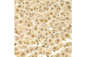Immunohistochemistry of paraffin-embedded rat liver using CDK4 Antibody (ABIN5970141) at dilution of 1/100 (40x lens).
