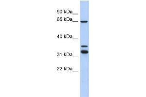 WB Suggested Anti-S100PBP Antibody Titration: 0. (S100PBP Antikörper  (Middle Region))