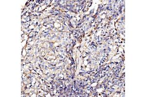 IHC analysis of NDUFAF1 using anti-NDUFAF1 antibody (ABIN7602459).