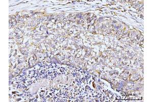 IHC analysis of GIT1 using anti-GIT1 antibody (ABIN7601683). (GIT1 Antikörper  (AA 415-736))