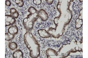 Immunoperoxidase of monoclonal antibody to CHFR on formalin-fixed paraffin-embedded human small Intestine. (CHFR Antikörper  (AA 1-652))