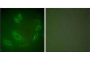 Immunofluorescence analysis of HeLa cells, using HSP105 Antibody. (HSPH1 Antikörper  (AA 791-840))