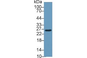 Western Blot; Sample: Mouse Liver lysate; Primary Ab: 1µg/ml Rabbit Anti-Mouse GSTm2 Antibody Second Ab: 0. (GSTM2 Antikörper  (AA 5-202))