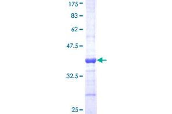 SOD3 Protein (AA 26-125) (GST tag)