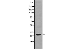SFT2D3 anticorps  (N-Term)