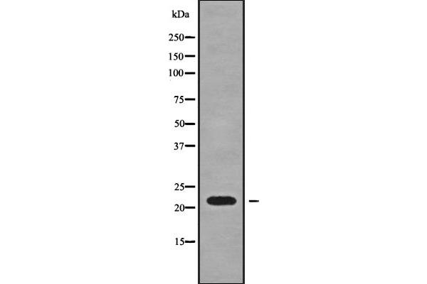 SFT2D3 Antikörper  (N-Term)