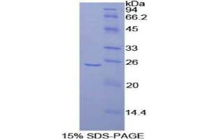 SDS-PAGE (SDS) image for Fibroblast Growth Factor Receptor Substrate 2 (FRS2) (AA 268-453) protein (His tag) (ABIN1877907) (FRS2 Protein (AA 268-453) (His tag))