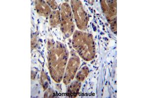 ZCRB1 Antibody (C-term) immunohistochemistry analysis in formalin fixed and paraffin embedded human stomach tissue followed by peroxidase conjugation of the secondary antibody and DAB staining. (ZCRB1 Antikörper  (C-Term))