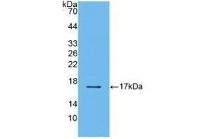 Detection of Recombinant TGFb2, Human using Polyclonal Antibody to Transforming Growth Factor Beta 2 (TGFb2) (TGFB2 Antikörper  (AA 303-414))