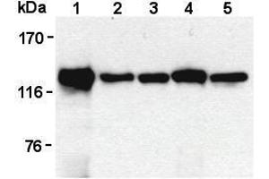Western Blotting (WB) image for anti-Signal-Induced Proliferation-Associated 1 (SIPA1) antibody (ABIN1449259)