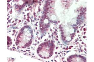 Human Small Intestine: Formalin-Fixed, Paraffin-Embedded (FFPE) (SMAD7 Antikörper  (AA 49-317))