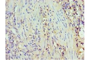 Immunohistochemistry of paraffin-embedded human epityphlon tissue using ABIN7173805 at dilution of 1:100 (BAFF Antikörper  (AA 76-285))