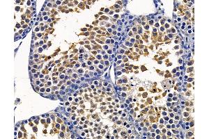 ABIN7095059 and ABIN7099115 at 1/100 staining mouse testis tissue by IHC-P. (TMEM126A Antikörper)