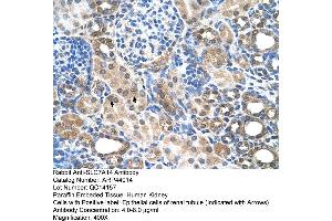 Human kidney (SLC7A14 Antikörper  (N-Term))