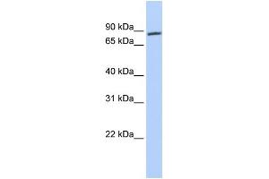 WB Suggested Anti-AR Antibody Titration: 0. (Androgen Receptor Antikörper  (N-Term))
