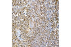 Immunohistochemistry of paraffin-embedded human tonsil using RPL13 Rabbit mAb (ABIN7269993) at dilution of 1:50 (40x lens). (RPL13 Antikörper)