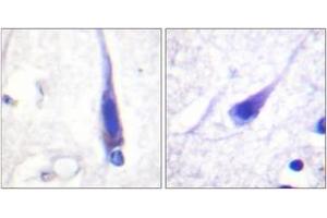 Immunohistochemistry analysis of paraffin-embedded human brain tissue, using Calmodulin (Ab-79/81) Antibody. (Calmodulin 1 Antikörper  (AA 46-95))