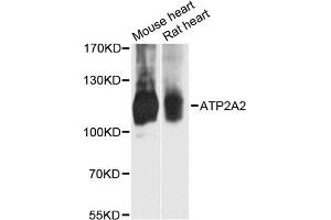 Western blot analysis of extracts of various cell lines, using ATP2A2 antibody. (ATP2A2 Antikörper)