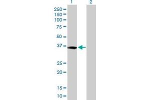 Western Blot analysis of XPA expression in transfected 293T cell line by XPA MaxPab polyclonal antibody. (XPA Antikörper  (AA 1-273))