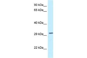 WB Suggested Anti-Tollip Antibody   Titration: 1.