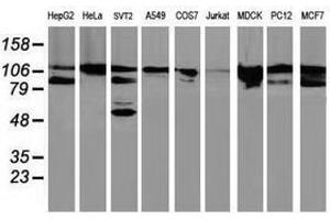 Image no. 6 for anti-Breast Cancer Anti-Estrogen Resistance 1 (BCAR1) antibody (ABIN1496832) (BCAR1 Antikörper)
