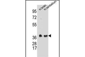 Synaptophysin 抗体  (C-Term)