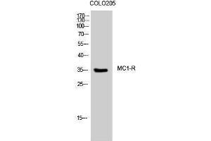 Western Blotting (WB) image for anti-Melanocortin 1 Receptor (MC1R) (C-Term) antibody (ABIN3185484)