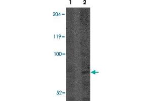 Western blot analysis of CNOT4 in A-549 lysate with CNOT4 polyclonal antibody  at (Lane 1) 1 and (Lane 2) 2 ug/mL . (CNOT4 Antikörper  (N-Term))