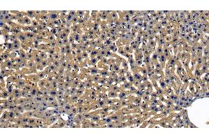 Immunohistochemistry (IHC) image for anti-Myeloid Differentiation Primary Response Gene (88) (MYD88) (AA 32-265) antibody (ABIN7433990)