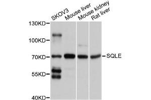 Western blot analysis of extracts of various cell lines, using SQLE antibody (ABIN5998952) at 1/1000 dilution. (SQLE Antikörper)