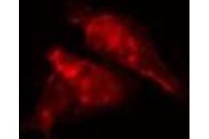 ABIN6277218 staining  HepG2 cells by IF/ICC. (EPB41 Antikörper  (Internal Region))