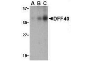 Immunocytochemical staining of DFF40 in K562 cells with DFF40 antibody at 10μg/ml. (DFFB Antikörper  (AA 203-218))