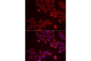 Immunofluorescence analysis of A549 cells using LGALS8 antibody. (LGALS8 Antikörper)