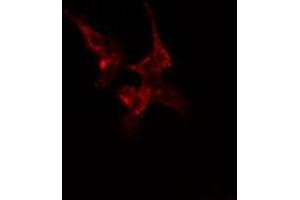 ABIN6275448 staining Hela cells by IF/ICC.