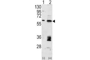 Western blot analysis of anti-MDM2 antibody and 293 cell lysate (2 ug/lane) either nontransfected (Lane 1) or transiently transfected with the MDM2 gene (2). (MDM2 Antikörper  (AA 393-424))
