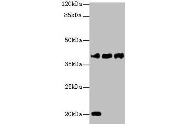 STEAP1 anticorps  (AA 3-69)