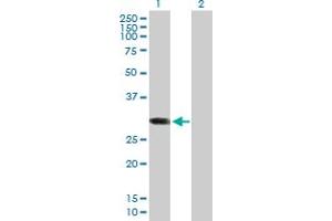 Western Blot analysis of ABCC10 expression in transfected 293T cell line by ABCC10 MaxPab polyclonal antibody. (ABCC10 Antikörper  (AA 1-282))